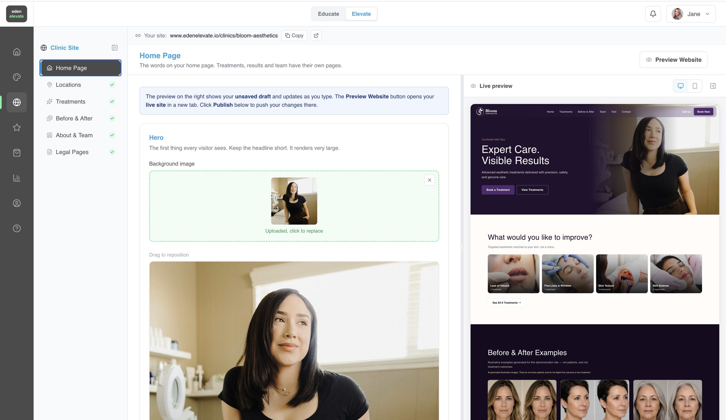 The Eden Elevate editor: edit your clinic site with a live preview alongside