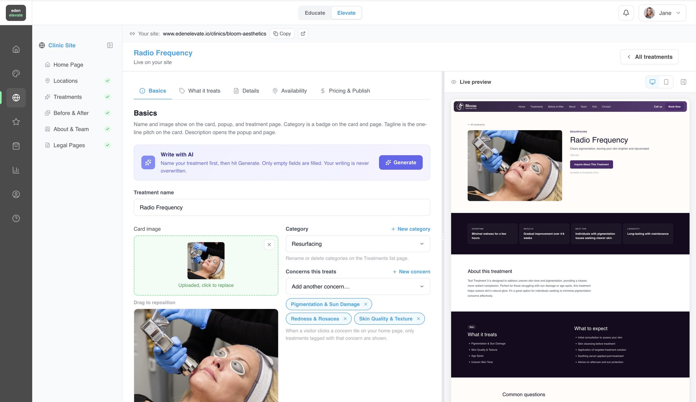 Setting up a treatment page in the Eden Elevate dashboard